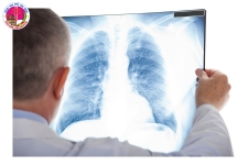 Truyền thông về sức khỏe phổi