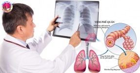 viêm phế quản phổi
