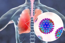 Phòng viêm phổi do cúm cần làm gì?