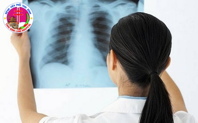 Phát hiện sớm bệnh lao phổi để tránh biến chứng nguy hiểm